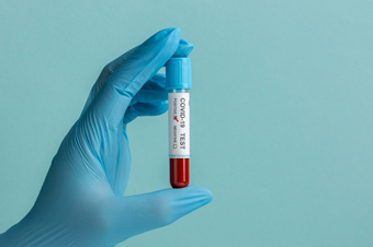Como funcionam os diferentes testes de coronavírus?